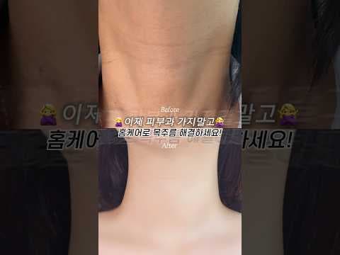 의학: 와케어 넥크림 후기, 2주 만에 목주름 개선 및 피부 탄력 효과?