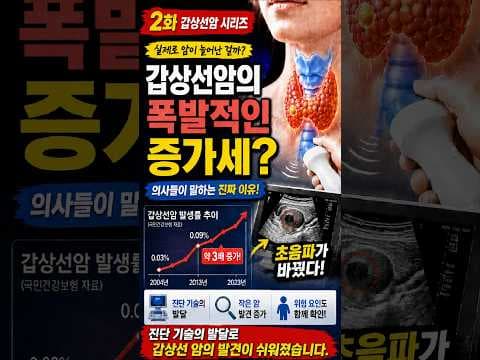 갑상선암 의학적 발생률 증가 원인: 초음파 검사 때문일까?