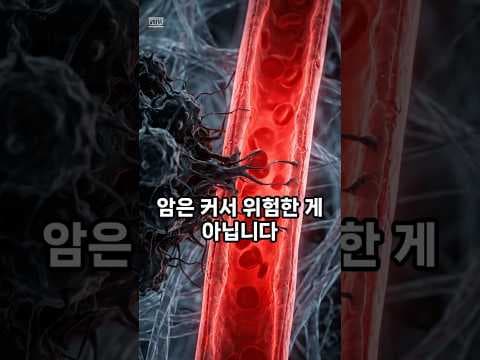 암 전이 막는 의학적 방법은? 새로운 치료 전략 집중 분석
