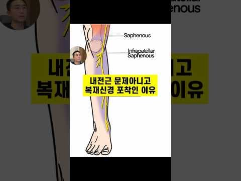 복재신경 포착 도침 치료 한의학적 접근 의학 정보 놓치면 후회해요!