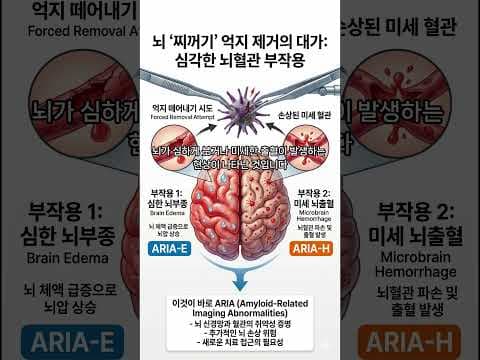스마트 기기로 뇌 건강 지키는 디지털 인지 치료: 효과 및 의학 정보