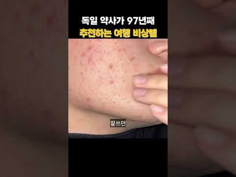 여행 중 피부 뒤집어짐? 의학적 원인과 세라일론 수딩밤 효능