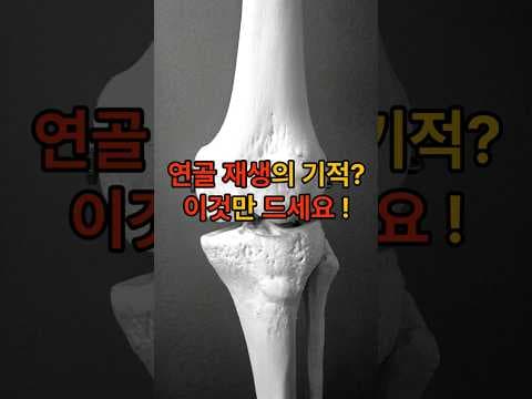 관절 건강 지키는 의학 정보: 연골에 좋은 음식 3가지