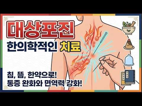 대상포진 의학: 한의학적 접근으로 고통 완화하는 방법