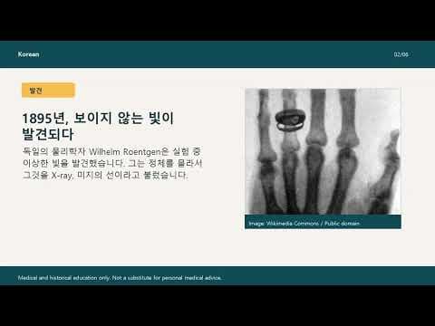 엑스레이 의학의 역사를 바꾼 빌헬름 뢴트겐의 위대한 발견