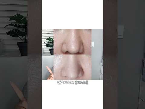 피지 연화제와 삭피기: 블랙헤드 없애는 의학적 홈케어 루틴