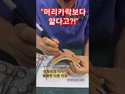 의학 미세 봉합술 흉터 최소화 위한 정교한 기술, 놓치면 후회해요!