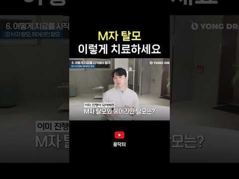 M자 탈모 의학적 치료법: 모발이식, 프로페시아, 아보다트 비교